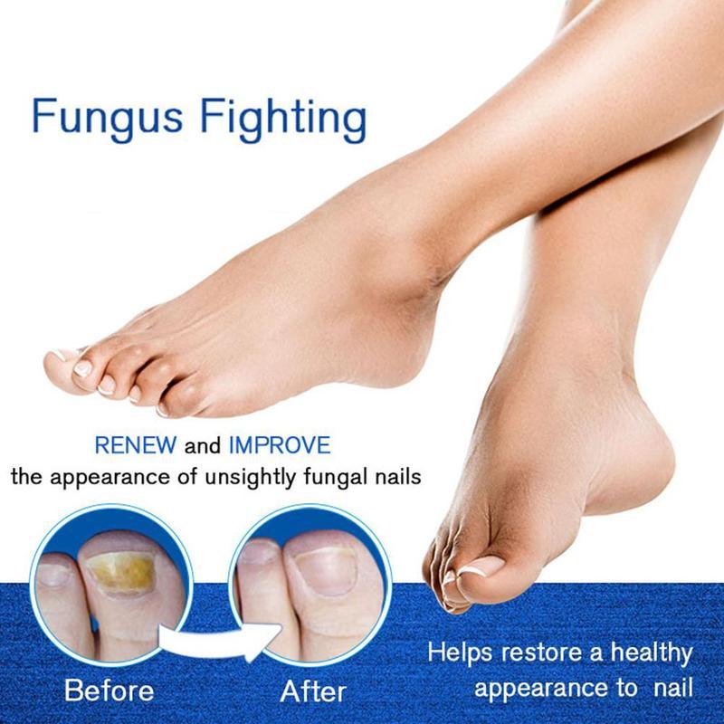 4ml Nail Repair Treatment Liquid Fungus Remover Protective Brush Nail Hand Pen Nourishing Foot Brightening Nail Care S6J8 - MY WORLD